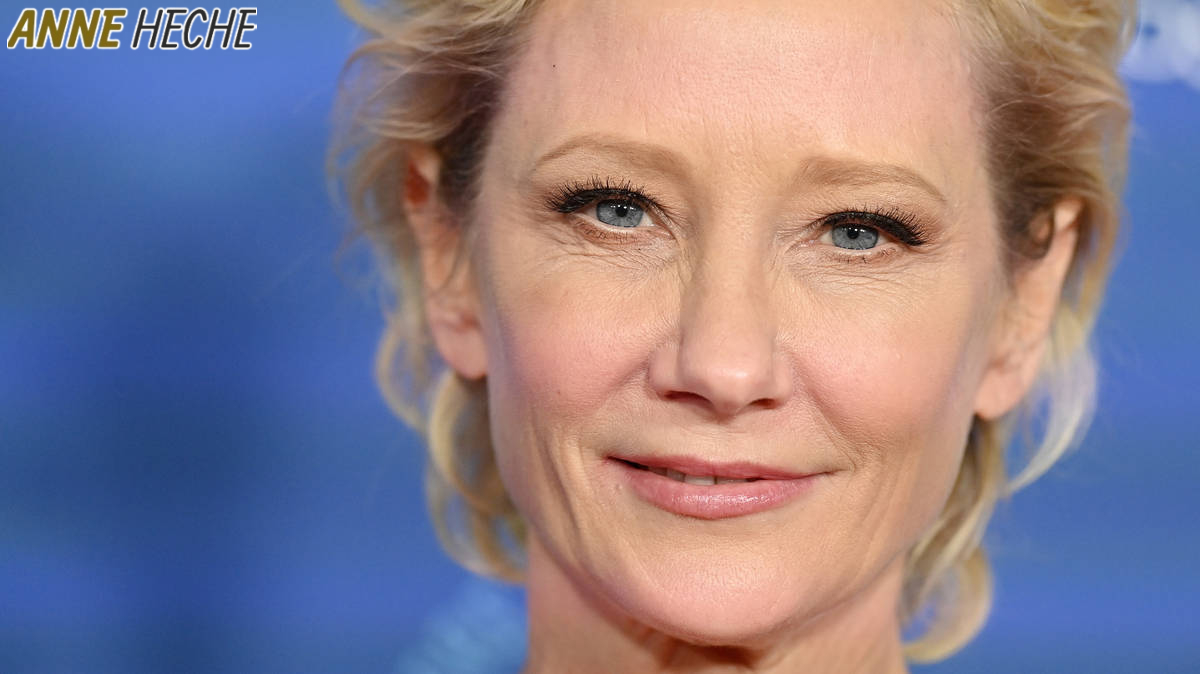 You are currently viewing Anne Heche Dead Or Alive